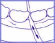 BetweenTeeth