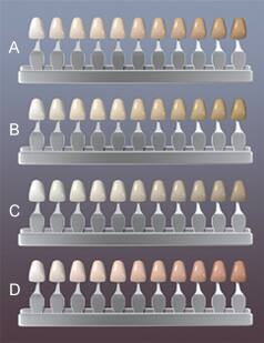 Cómo Determino el Color 

Específico de Mis Dientes